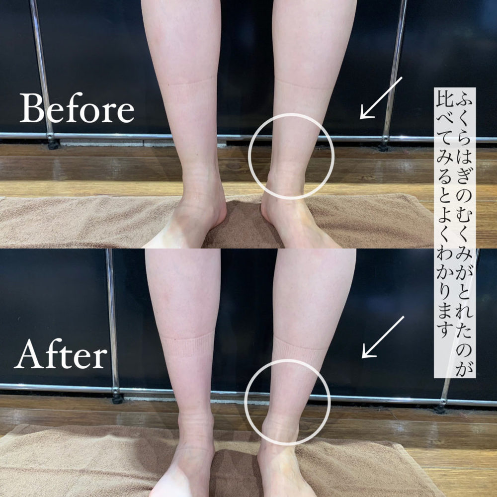ふくらはぎを筋膜リリースするやり方 脚やせ むくみ改善など効果多数 Slope スロープ